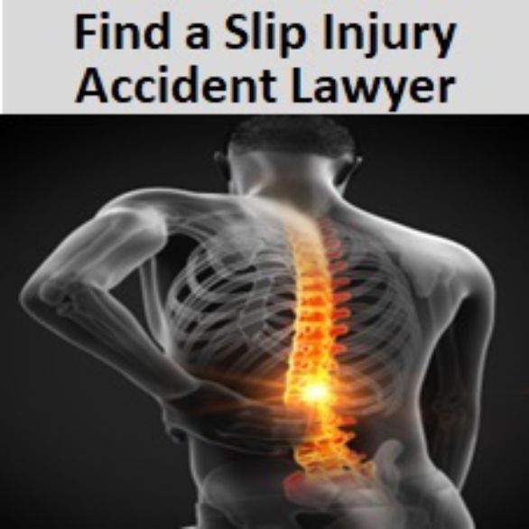 Find a UK Slip Injury Accident Lawyer to make a claim for a floor slip or trip injury accident